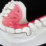 Wydruki 3D